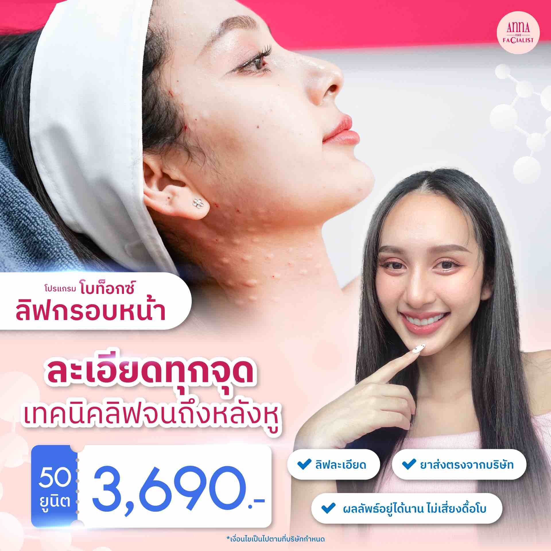 Botox ลิฟหน้า ละเอียด แอนน่า คลินิก
