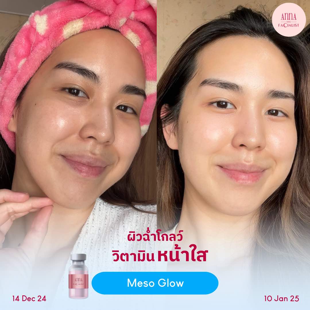 Meso glow รีวิว 2