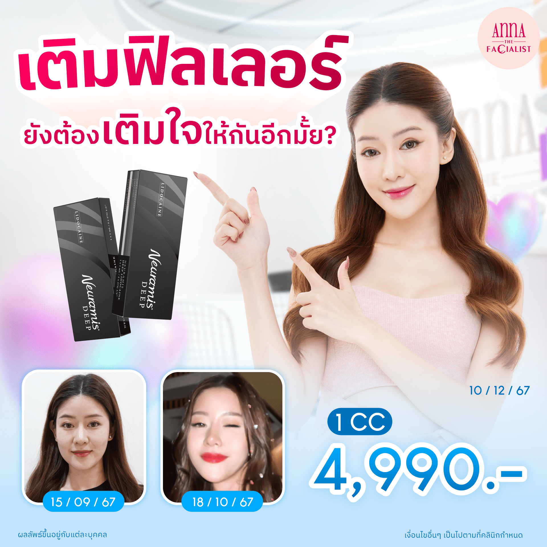 Neuramis เติมฟิลเลอร์ เติมใจ 1