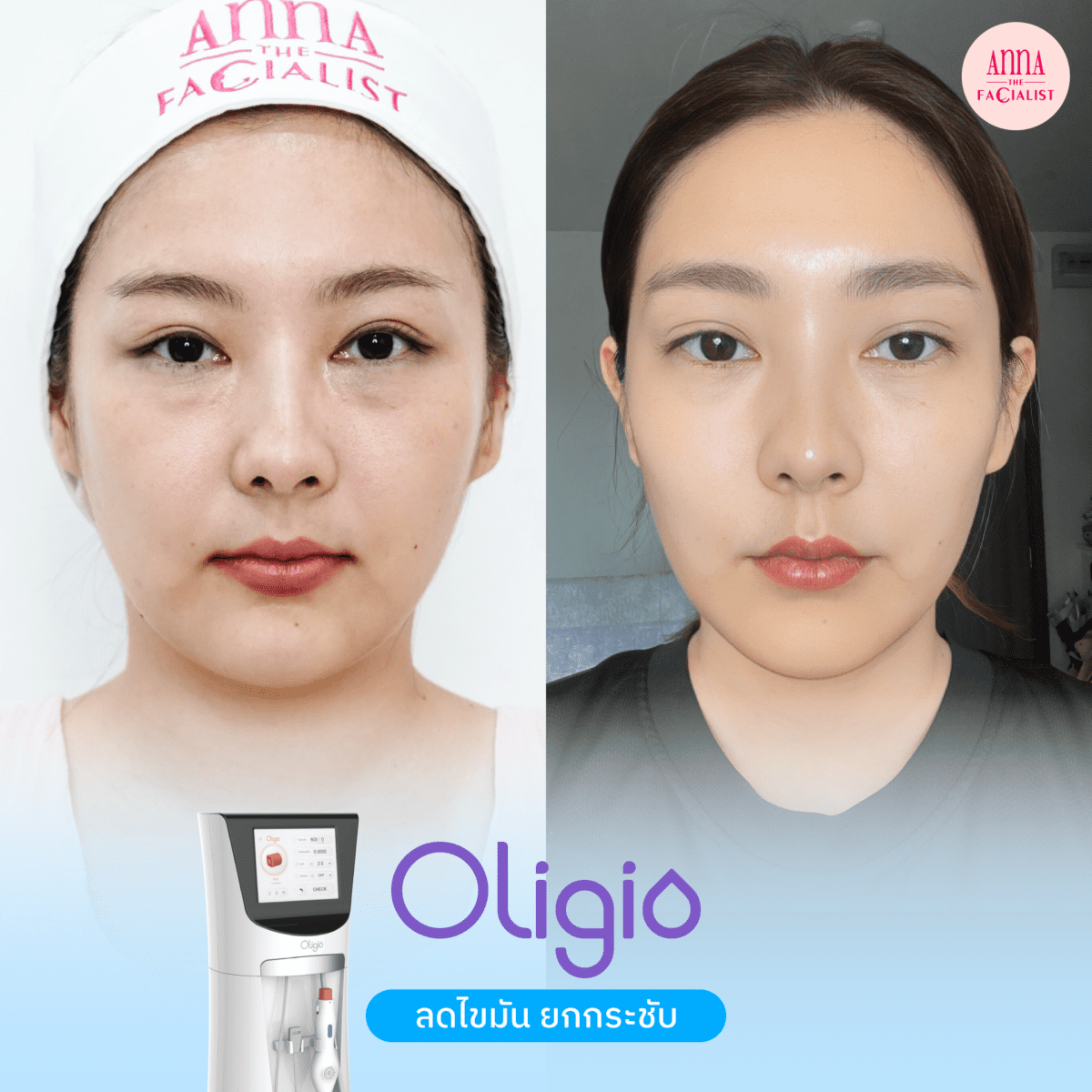 oligio รีวิว1
