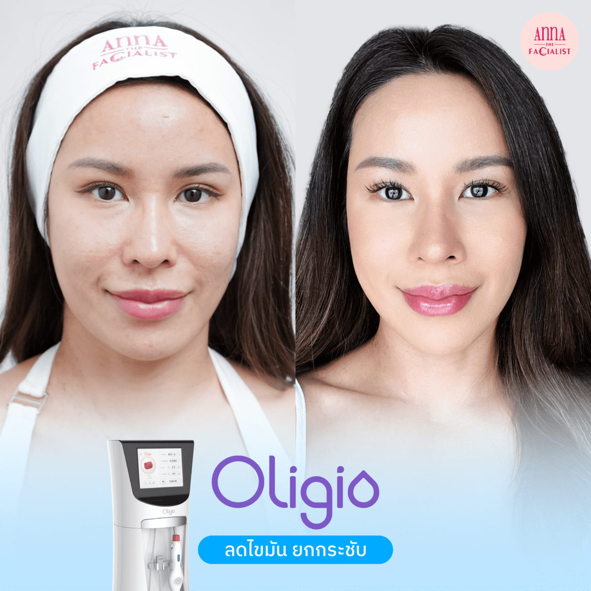 oligio รีวิว2